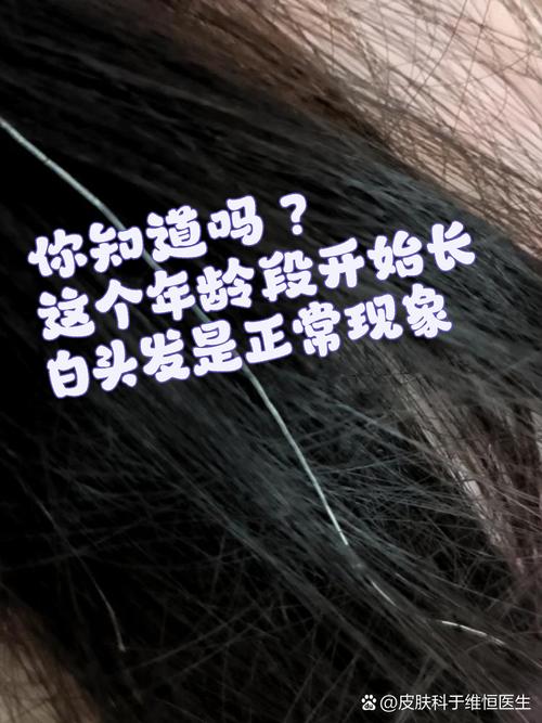 身体警报张雨欣__扎白头绳什么意思