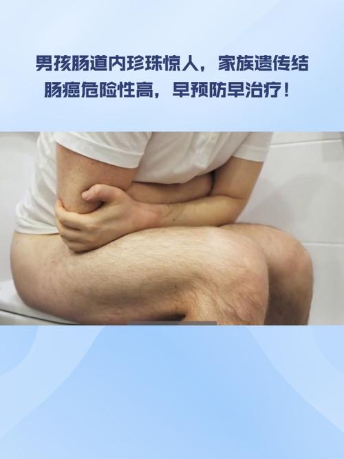 珍珠堵塞肠道__肠道造影能查出肠癌吗