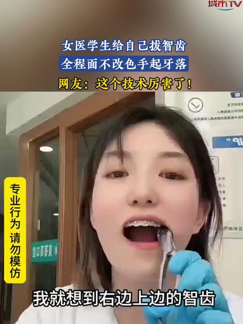 牙医生拔牙视频__牙医拔牙表情包